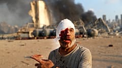 جريح في انفجار الرابع من آب/أغسطس 