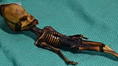La triste historia detrás del falso alienígena de Atacama