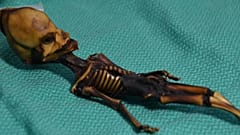 Mystery solved: alien-like skeleton found in Chile ‘was human’