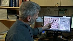 New organ could help understand spread of cancer