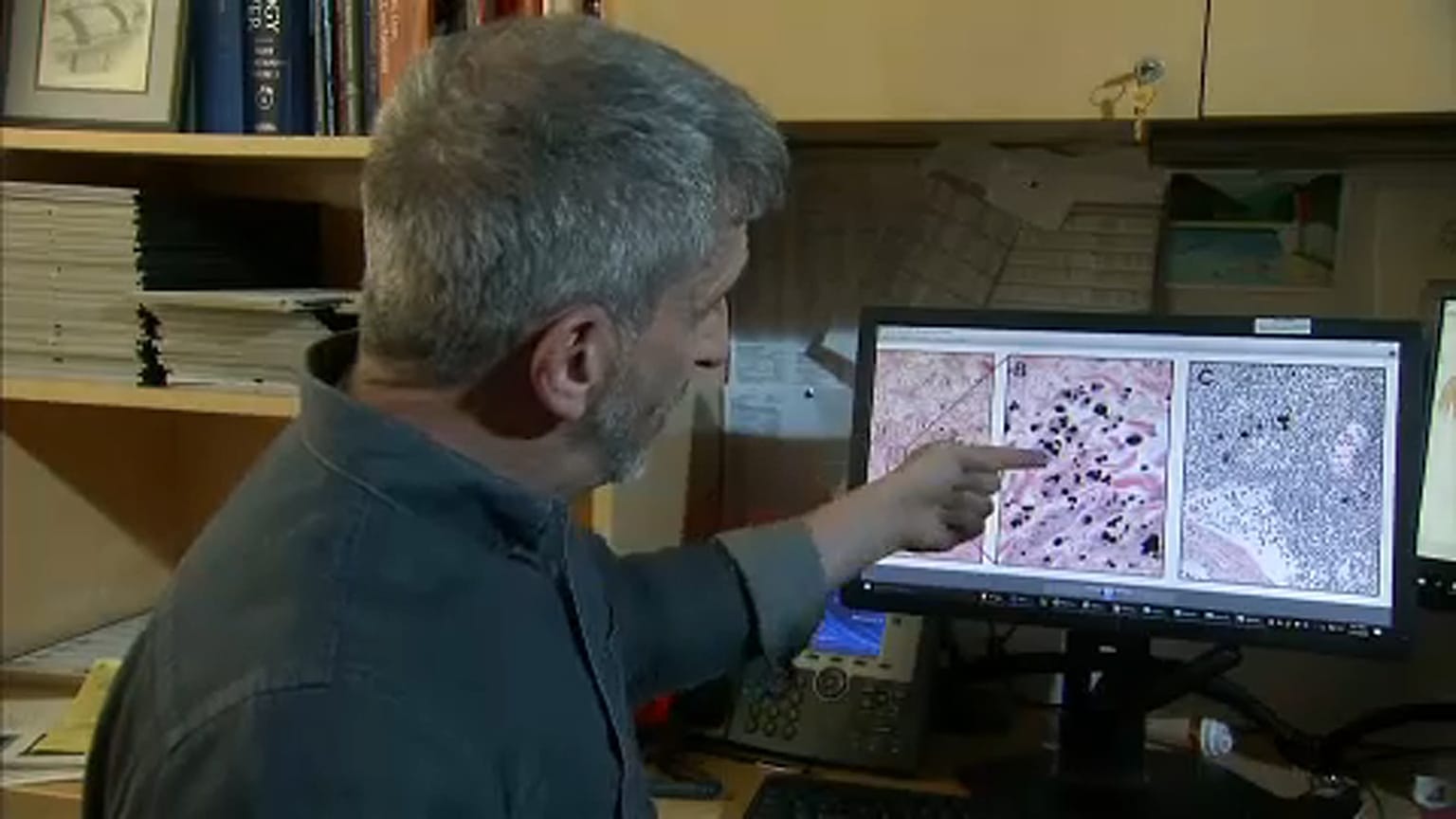 Hallott már az interstitiumról? Nem? Pedig ez lehet a legnagyobb szerve
