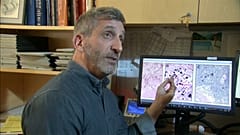 Intersticio: el nuevo órgano que puede ayudar a entender la propagación del cáncer