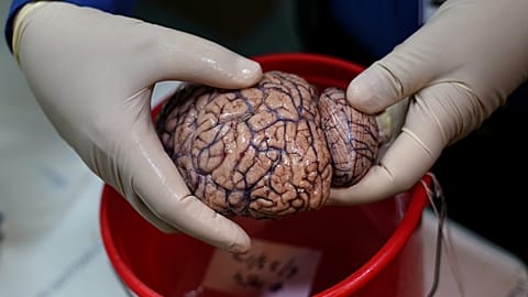 A human brain
