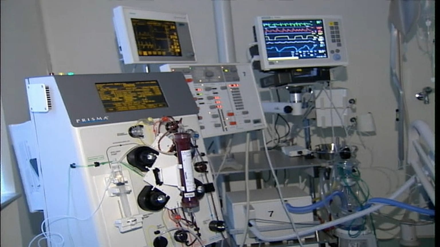 Alfie, l'appello della zia: "Serve l'attrezzatura portatile per la ventilazione assistita"