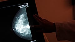 Erreur de dépistage en Angleterre