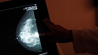 Erreur de dépistage en Angleterre
