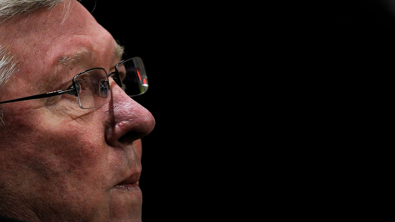 Football : Sir Alex Ferguson opéré du cerveau