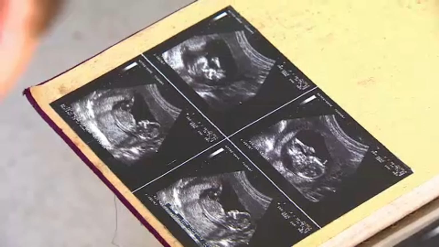 Via l'aborto dal codice penale: il dibattito che infiamma il Belgio