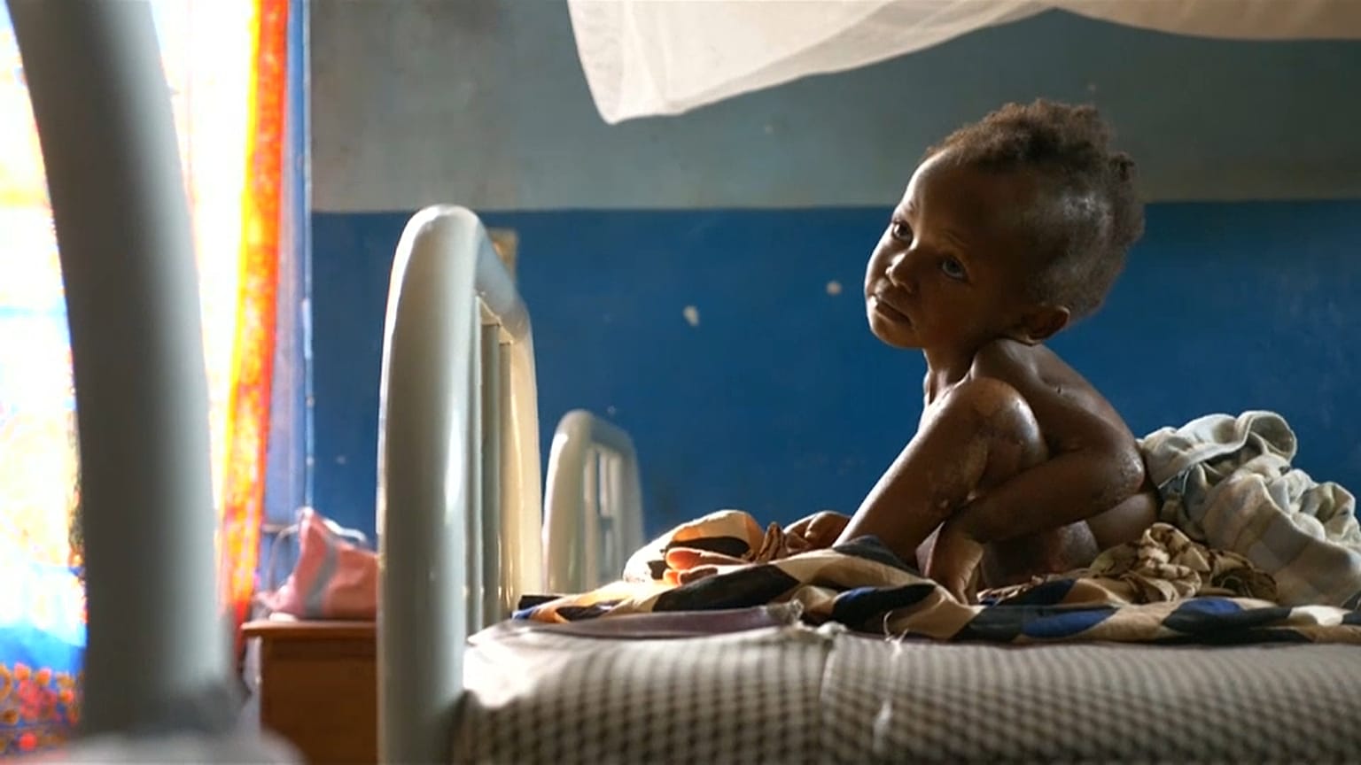 400.000 Kindern im Kongo droht der Hungertod