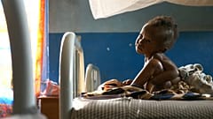 400.000 Kindern im Kongo droht der Hungertod