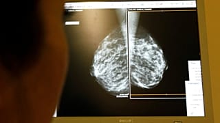 Magyarok fejlesztik a sarki patikából beszerezhető, daganatfelismerő tesztet