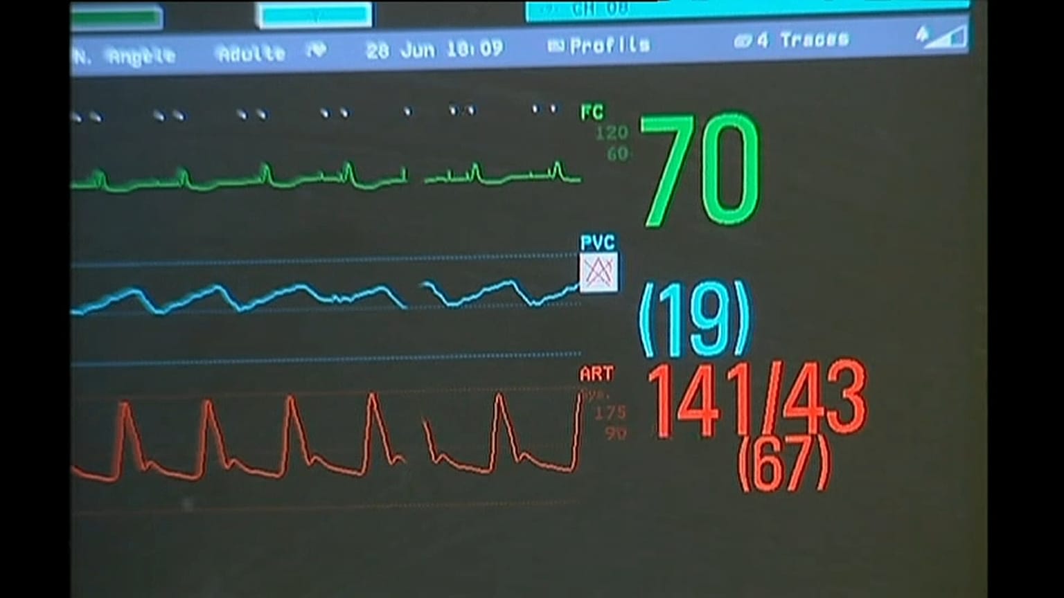 Assisted dying is a divisive issue in many countries