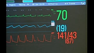 Assisted dying is a divisive issue in many countries