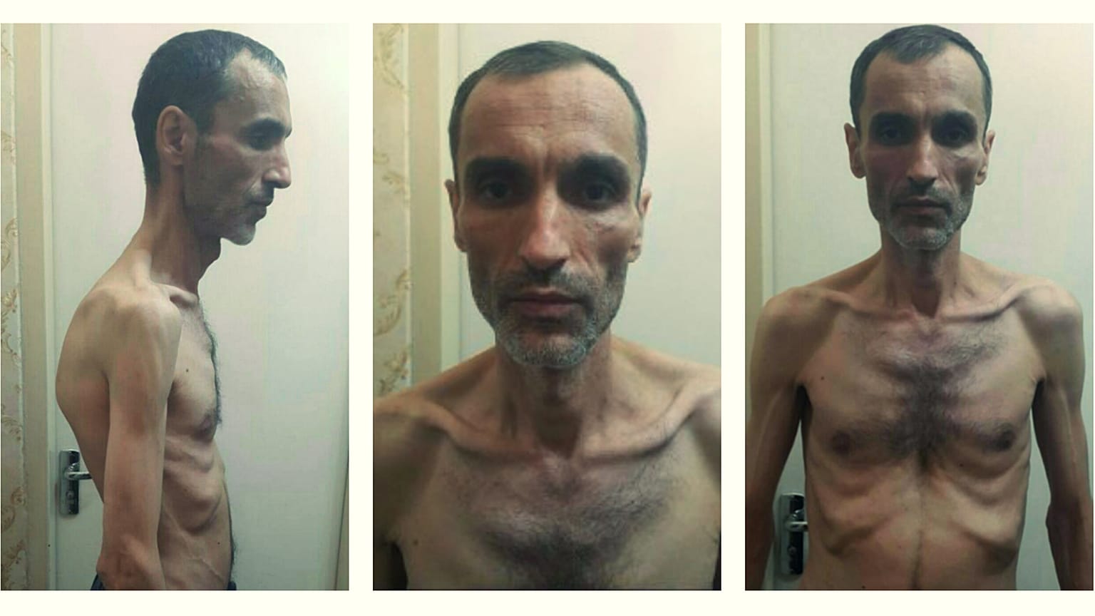 واکنش‌های گسترده به انتشار تصاویر حمید بقایی پس از اعتصاب غذا