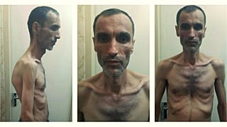 واکنش‌های گسترده به انتشار تصاویر حمید بقایی پس از اعتصاب غذا