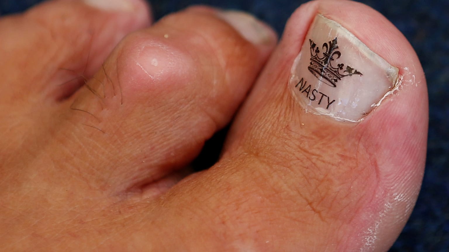 The toe of Alan "Nasty" Nash.
