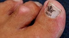 The toe of Alan "Nasty" Nash.