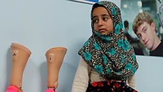 Konserve kutusundan protezleri Maya'ya yeni bir hayat sundu