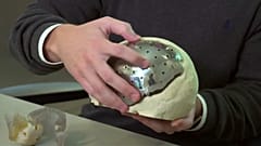 Brasil inova na medicina em 3D