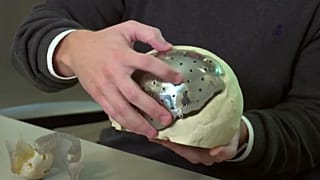 Brasil inova na medicina em 3D