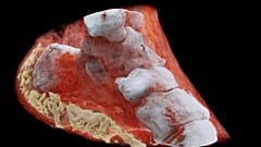 اشعه ایکس سه بعدی و رنکی