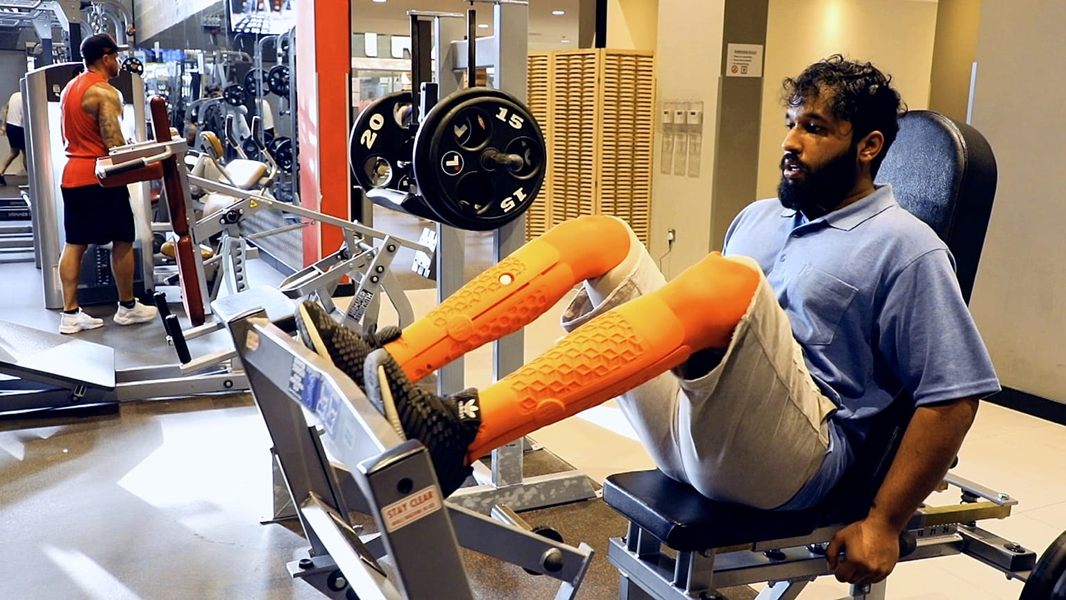 How are 3D-printed limbs changing lives in the UAE?
