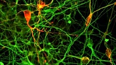 Soigner Parkinson grâce aux cellules souches