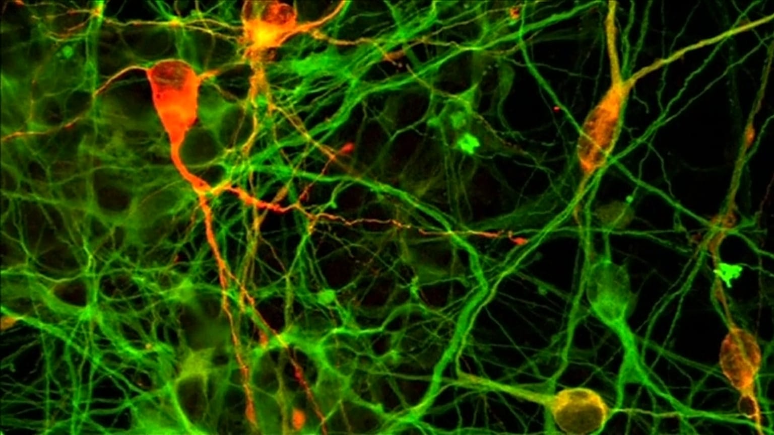 Parkinson: via alla sperimentazione con le staminali sugli esseri umani