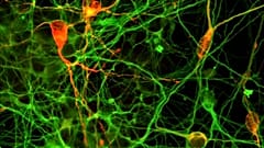 Parkinson: via alla sperimentazione con le staminali sugli esseri umani