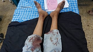 افغانستان؛ ده‌ها مسافر اتوبوسی در انفجار بمب کنار جاده‌ای کشته و زخمی شدند 