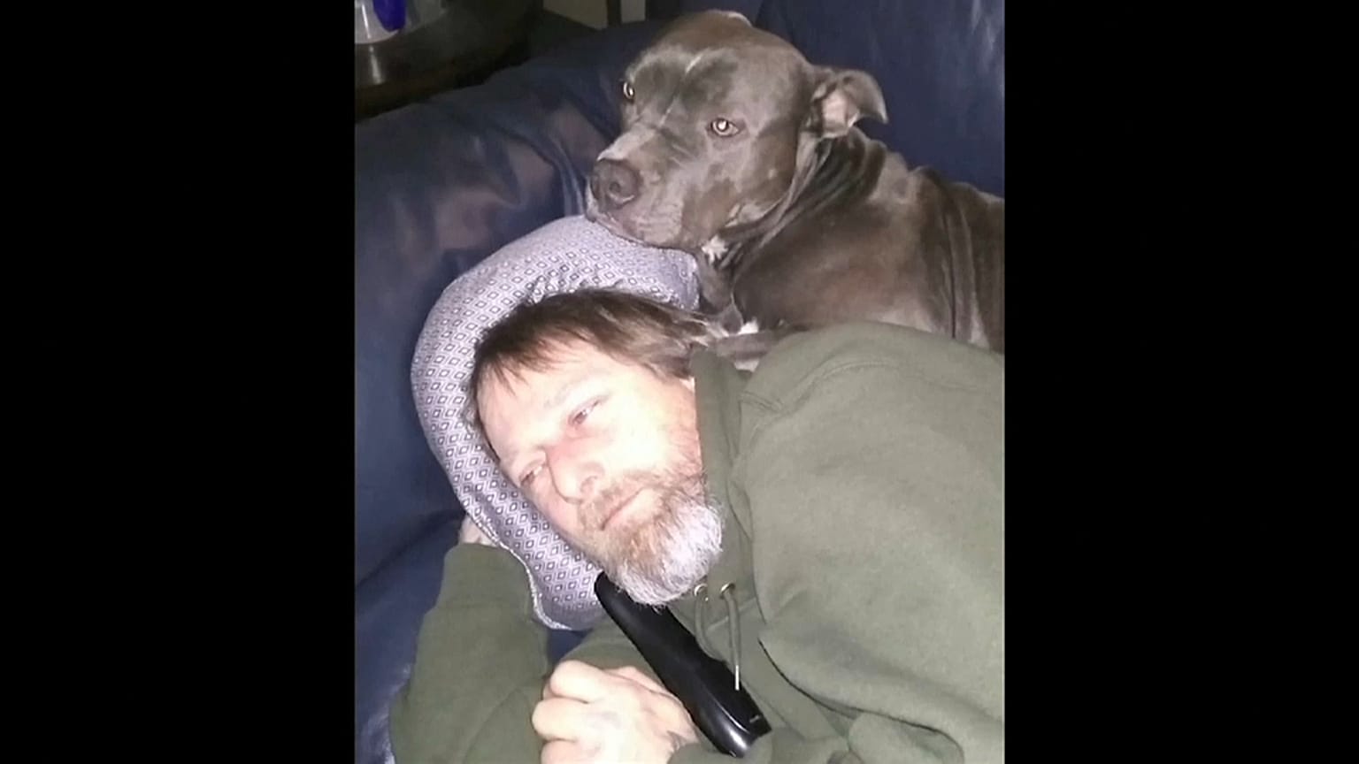 Amputado por los lametazos de un perro
