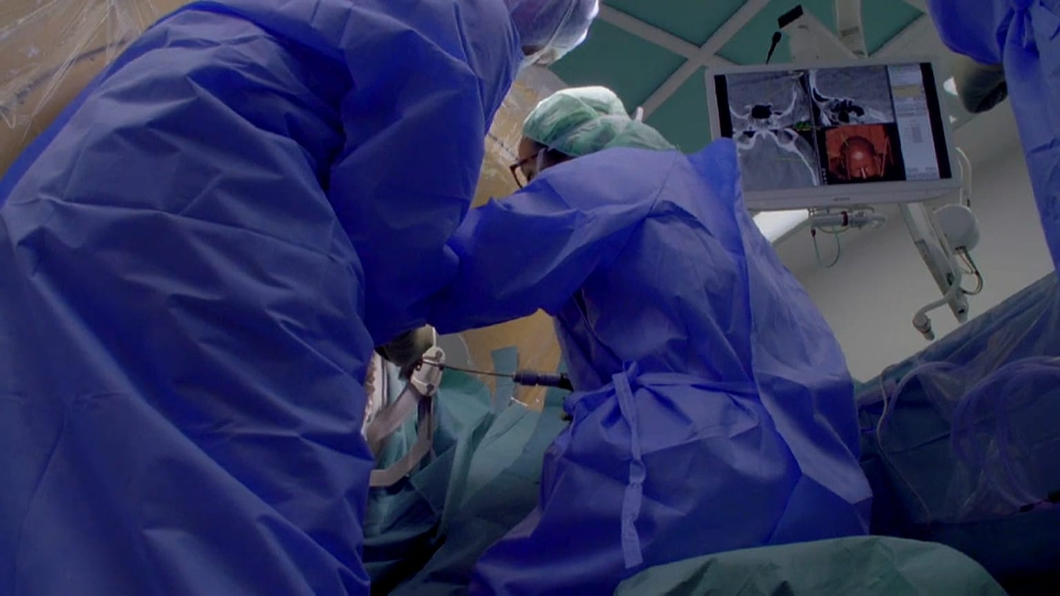 Epilepsie : opération à la fibre laser inédite en Europe