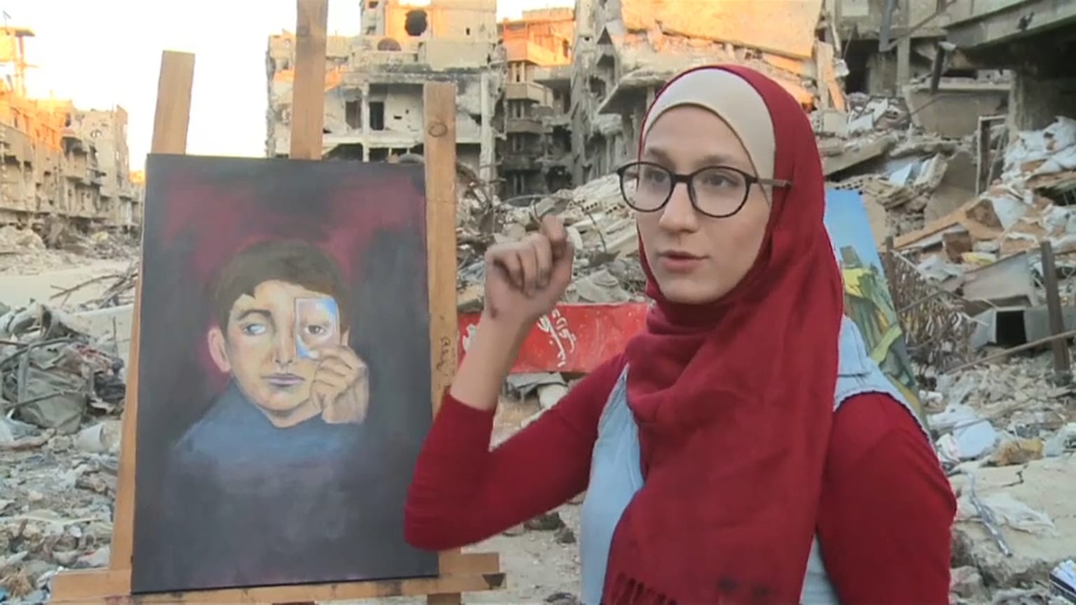 رسمت معاناة طفل حقيقية فقد عينه في الحرب