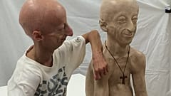 Sammy Basso: El italiano de 22 años que parece un anciano