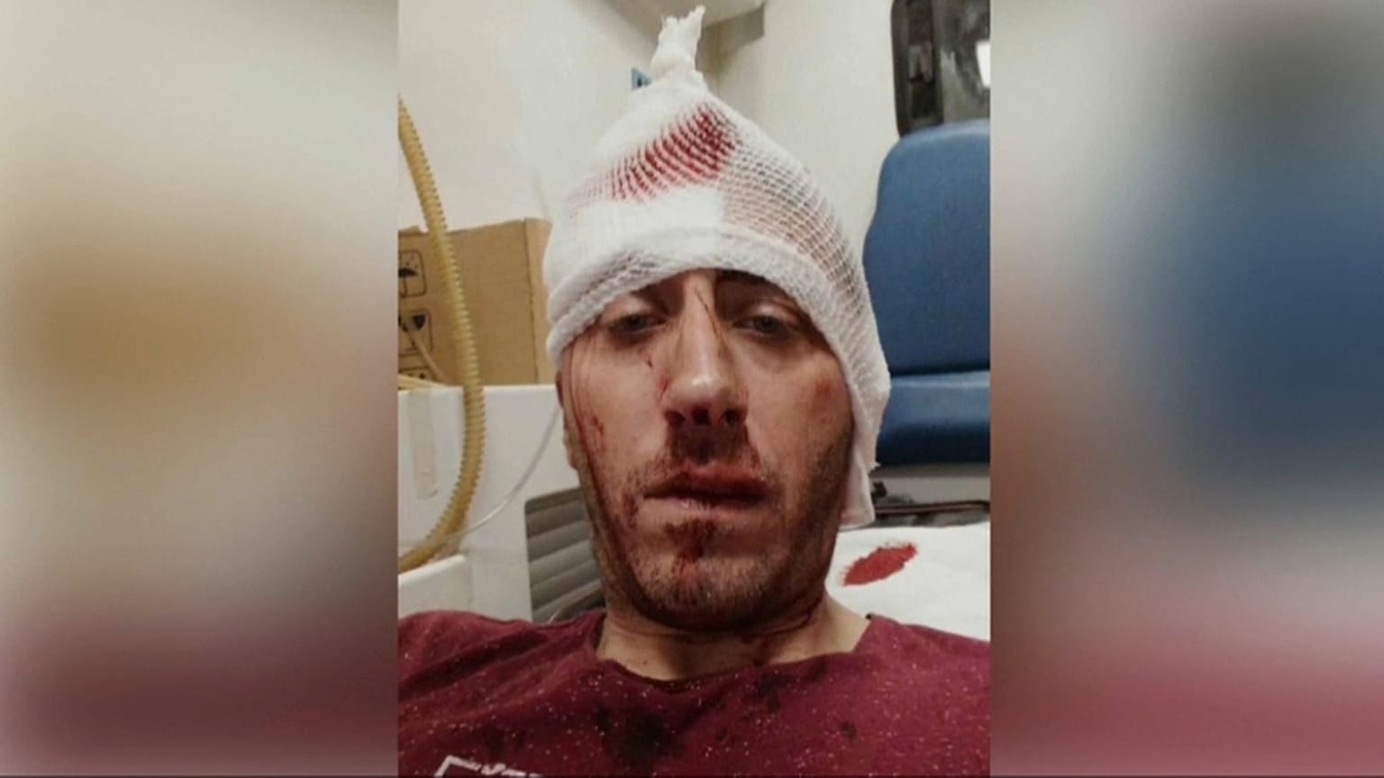 Jornalistas protestam contra agressão sofrida por repórter em Banja Luka 