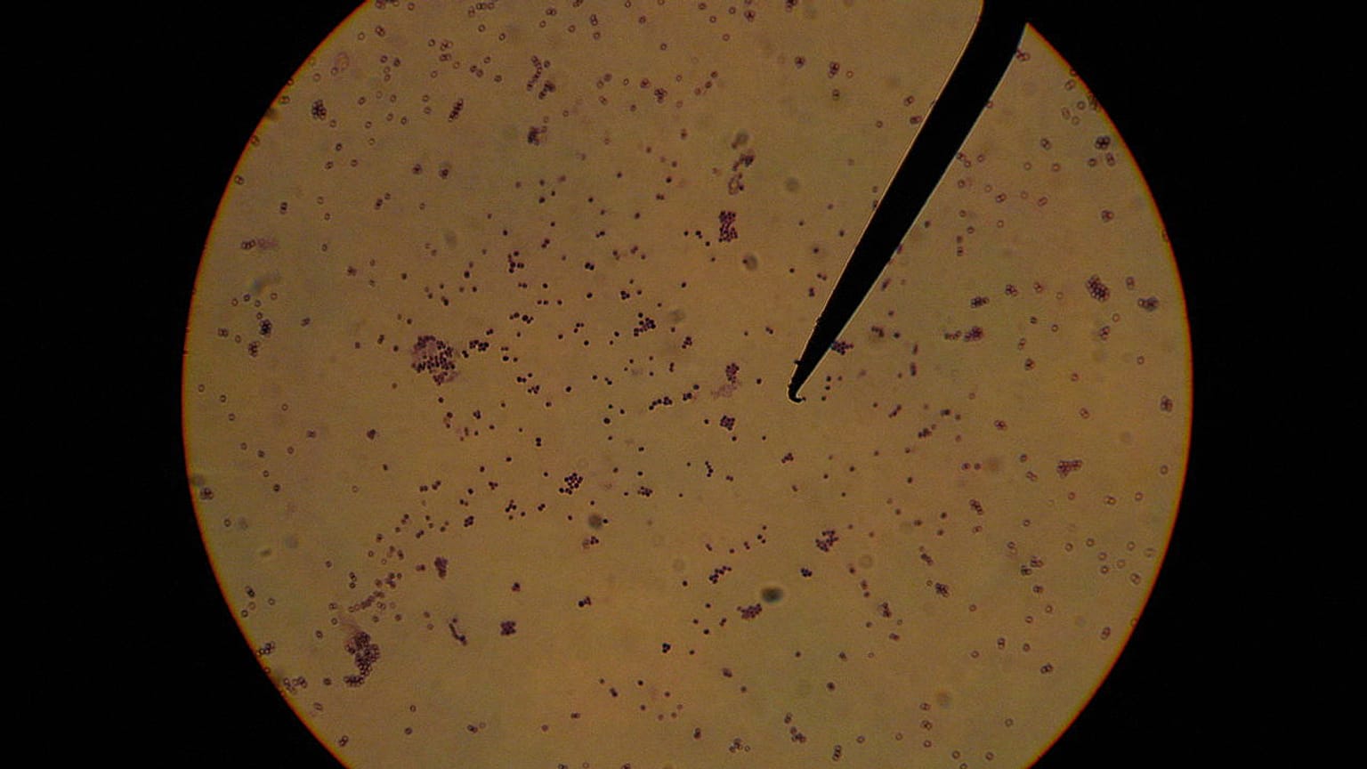 Cultivo de estafilococo epidermidis