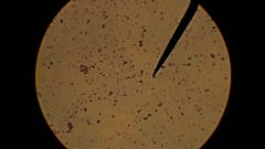 Cultivo de estafilococo epidermidis