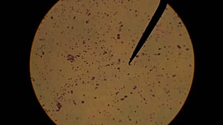 Cultivo de estafilococo epidermidis