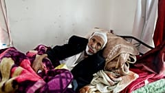 In photos: Suffering from cancer amid war in Yemen