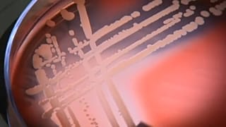 Superbakterium - Antibiotika wirkungslos