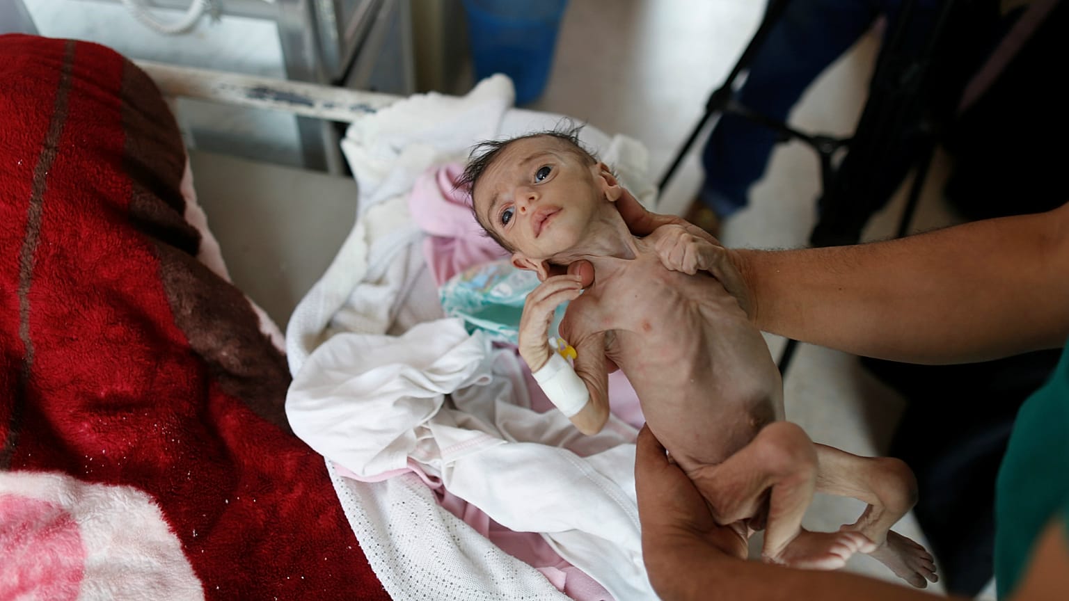 UNICEF: Yemen savaşı çocuklar için canlı bir cehennem 