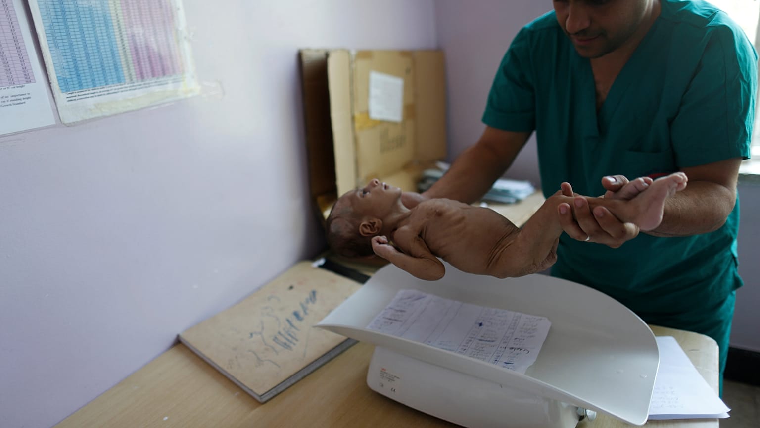 Yemen’de 5 milyondan fazla çocuk açlık tehdidiyle karşı karşıya