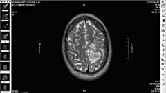 Images from MRI