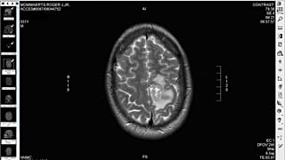 Images from MRI