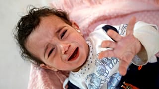 Kolera hastası Yemenli bir kız çocuğu Sanaa'da bir hastanede 11.10.2018