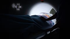 La deuda de América Latina con el cáncer de mama en cifras 