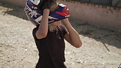 Έξαρση γεννήσεων παιδιών χωρίς χέρια