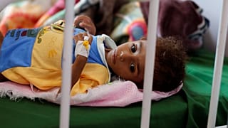 Yemen: 5 milioni di minori a rischio inedia