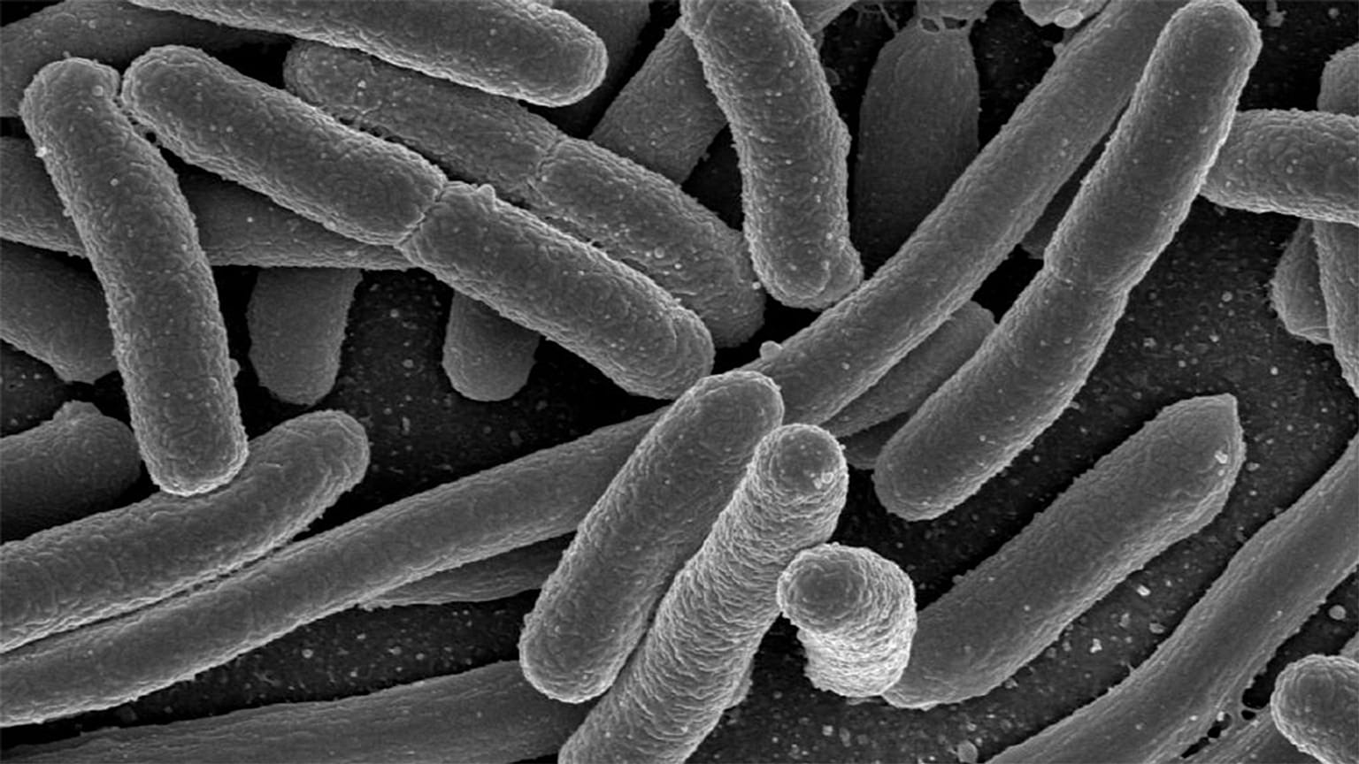 2,4 millióan halhatnak meg szuperbaktériumok miatt 2050-ig