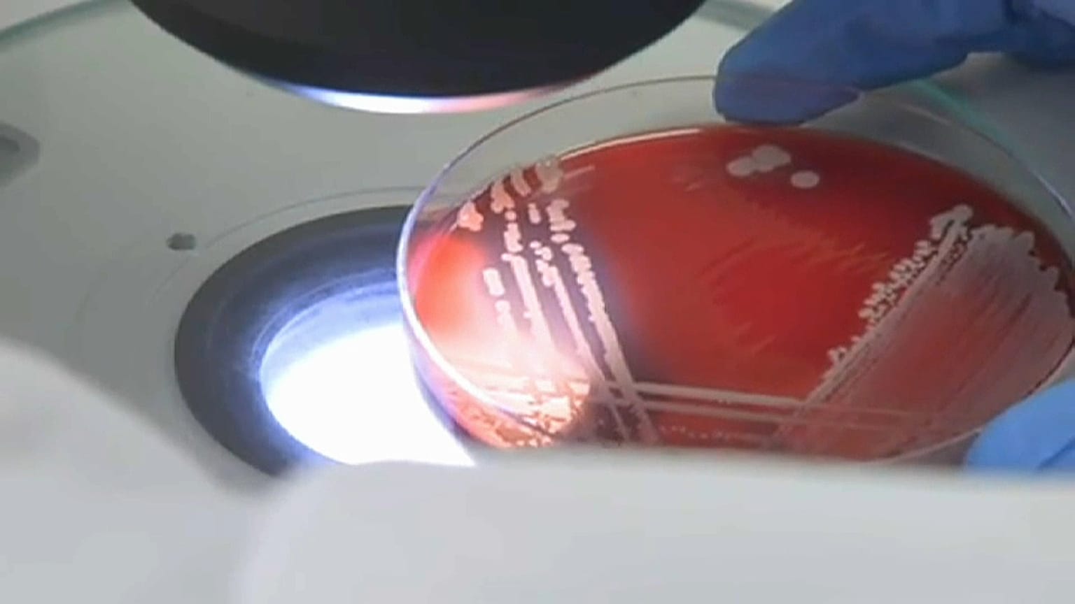 Bacteria studied under a microscope for antibiotic resistant strains